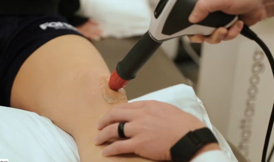 Shockwave Therapy treatment offered at Forté Sports Medicine in Carmel, Indiana