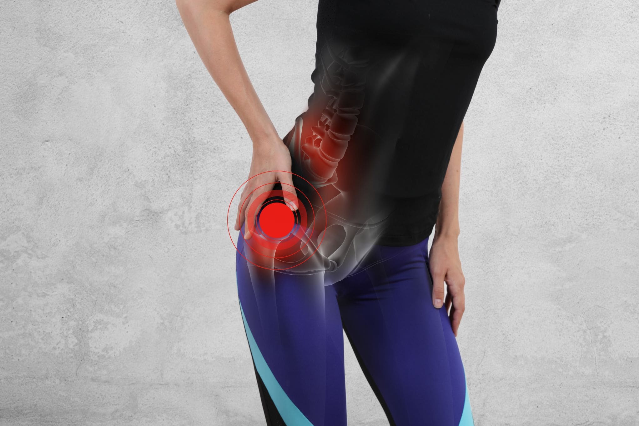 Hip Bone Spurs: Causes, Symptoms and Treatment Options